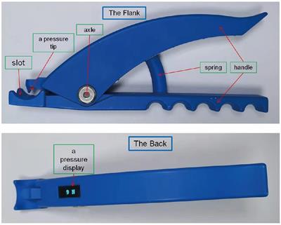 Mechanical digit sensory stimulation: a randomized control trial on neurological and motor recovery in acute stroke